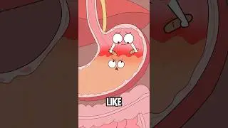 Why does drinking too much alcohol give you a stomachache?#animation #funny #shorts #health