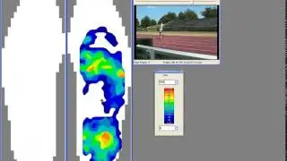 F-Scan&trade; Wireless for In-Shoe Plantar Pressure Analysis