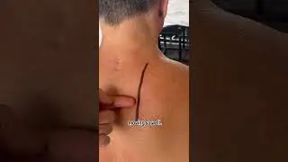 That KNOT that never goes away!