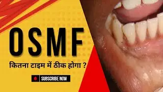 OSMF Big Problem in India 🇮🇳 #osmf #dentist #dentaltreatment #doctor @DentalWalaGyan