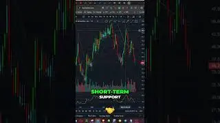 Cathie Wood Makes Headlines with 10X Genomics Stock Purchase #shorts