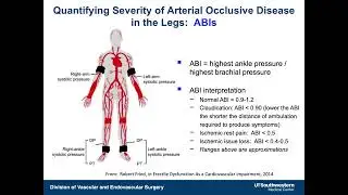 LE Arterial Physiologic Testing