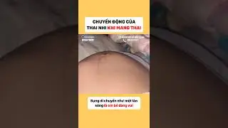 Những chuyển động của thai nhi khi mang thai #thaimay #chuyendongcuathainhi #kienthucmangthai