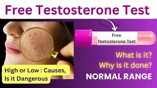 Free Testosterone Test - Meaning, Symptoms, Procedure, Normal Range, Causes of High and Low Levels