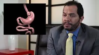 Gastric Bypass - Tijuana, Mexico - Monterrey, Mexico