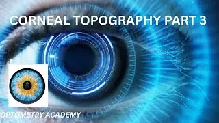CORNEAL TOPOGRAPHY part 3: Scheimpflug Camera based system, Scheimpflug Principal