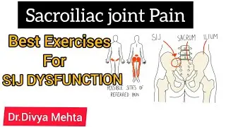 How to fix side back pain?/ BEST EXERCISES FOR SI JOINT DYSFUNCTION