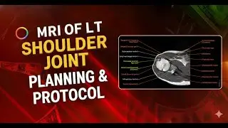 MRI of Left Shoulder Joint Planning | Easy Explanation for Beginners