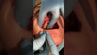 Pop goes a baby tooth! 🦷