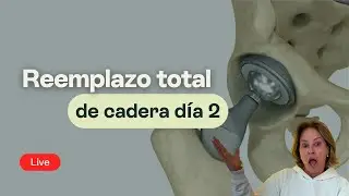Reemplazo total de cadera d&iacute;a 2