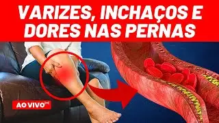 M&Aacute; CIRCULA&Ccedil;&Atilde;O nas PERNAS e P&Eacute;S ( secagem e aplica&ccedil;&atilde;o das varizes, varicose e trombose ) - Dr. Alex