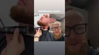 From one Bald Guy to another, shave it off...