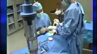 Rapid Recovery Facelift Portland OR Call 503-446-5300