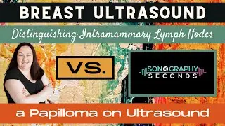Breast Ultrasound (Intramammary Lymph Node vs Papilloma)