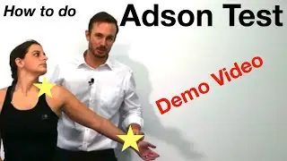 How to do the Adson Thoracic Outlet Test