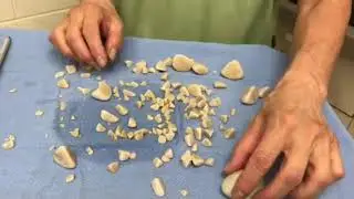 The Doc Is In | Episode 5 | Bladder Stones