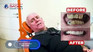 Smile Design I John Tonner's Journey