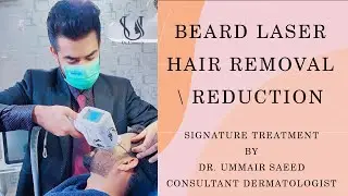 Beard Laser Hair Removal