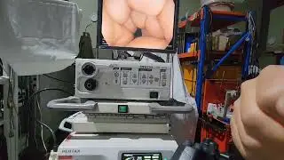 Pentax EG-2790k ultra-slim video gastroscope