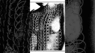 Kakerlak - Among the Minutiae - Side One