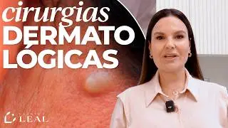 RETIRADA DE PINTAS, CISTOS E FIBROMAS: Cirurgias Dermatol&oacute;gicas Simples e Eficazes | Cl&iacute;nica Leal