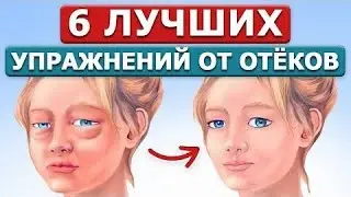 УБРАТЬ ОТЕКИ С УТРА ЗА 3 МИНУТЫ! 🔥 Мгновенный эффект! ДЕЛАЙ ЭТО.💥