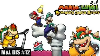 Mario & Luigi Bowser's inside story playthrough part:12 - Get slim fast program