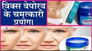 विक्स वेपोरब के चौकाने वाले प्रयोग।  Surprising Benefits And Uses Of Vicks Vaporub