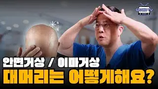 [그랜드성형외과] 대머리는 안면거상 / 이마거상 어떻게 해요?
