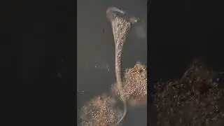 microscopy video - stentor