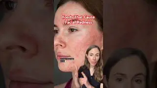 5 Foods That Make Your Face Red
