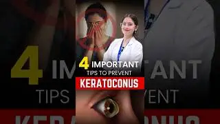 Stop Keratoconus Before It Starts | 4 Eye Care Tips