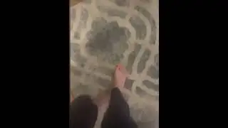 Toe Curling in Parkinson's Disease