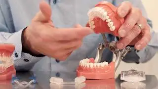 Partial Coverage Dental Guards
