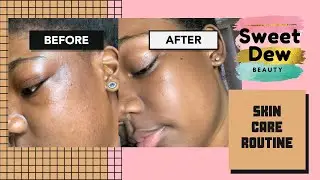 Skin Care Routine X Sweet Dew Beauty| MeShoLayLay