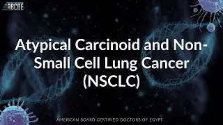 Oncology Boards: Case-Based Lung Cancer: Atypical Carcinoid & Non-Small Cell Lung Cancer