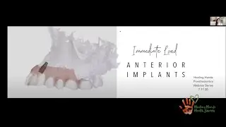 Anterior Load Immediate Implants By Dr Gabrielle Jackson