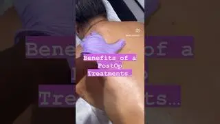 Massage After A BBL! #bbl #bblrecovery #miamisurgery #cosmeticsurgery #postopcare