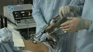 Gastric Band Fitted at Birmingham's Heartlands Hospital