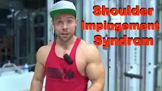 Rotatorenmanschetten trainieren - Shoulder Impingement Syndrom vorbeugen