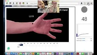Reading the Average Levels on an AcuGraph