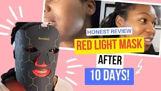 Red Light Therapy on Black Skin Review | Redlight Mask Benefits??