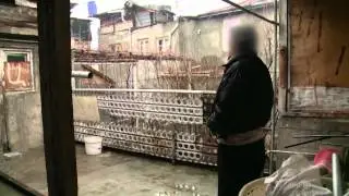 Drug Resistant TB