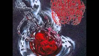 Necroptic Engorgement - Gorgotron of Nusance
