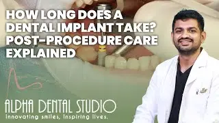How Long Does A Dental Implants Take? Post - Procedure Care Explained | Alpha Dental Studio
