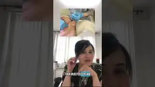 Skin Boosters : Are They Worth the Hype? Featuring Neauvia Hydro Deluxe
