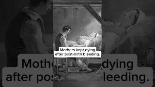 The Doctor Who Stopped Mothers From Bleeding to Death. #history #educational