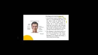 closed craniocerebral trauma.