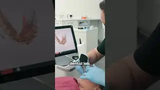 Dental CAD CAM  A Revolution in Dentistry