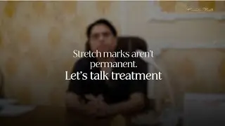 Stretch Marks Treatment Explained | Stretch Marks Hatane Ke Effective Tarike